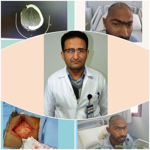 مستشفى الملك سعود بعنيزة ينقذ حياة مقيم نيبالي تهشمت جمجمته